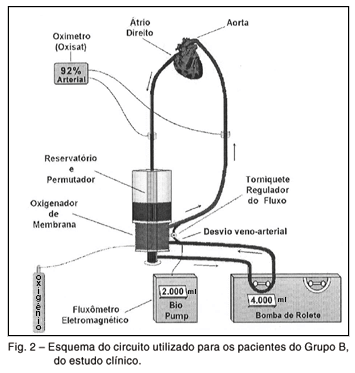 Braz J Cardiovasc Surg - 50 anos de circulação extracorpórea no