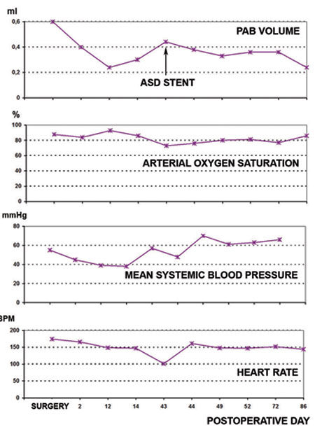 Braz J Cardiovasc Surg - The pulmonary vascular blood supply in