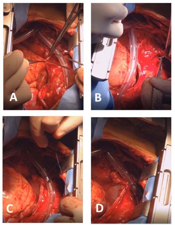 Operate Now: Pericardium Surgery em Jogos na Internet