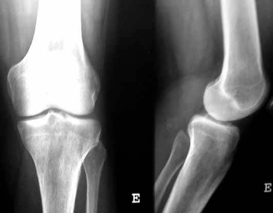 tratamentul magnetic articular