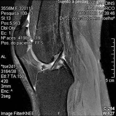 tratamentul magnetic articular