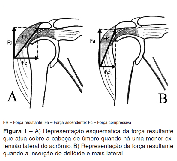 Revista Brasileira de Ortopedia ESTUDO RADIOGRÁFICO DO ÍNDICE ACROMIAL E SUA RELAÇÃO COM AS Revista Brasileira de Ortopedia ESTUDO RADIOGRÁFICO DO ÍNDICE ACROMIAL E SUA RELAÇÃO COM AS